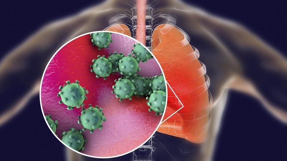 Efectos del Conoravirus en el cuerpo Imagen: Getty Images
