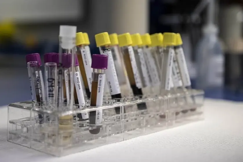 El coronavirus ataca m&aacute;s a este grupo sangu&iacute;neo