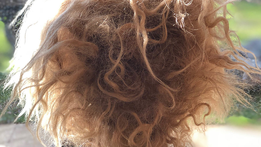 Síndrome del cabello rebelde, imagen referencial. (Foto: Infoabe).