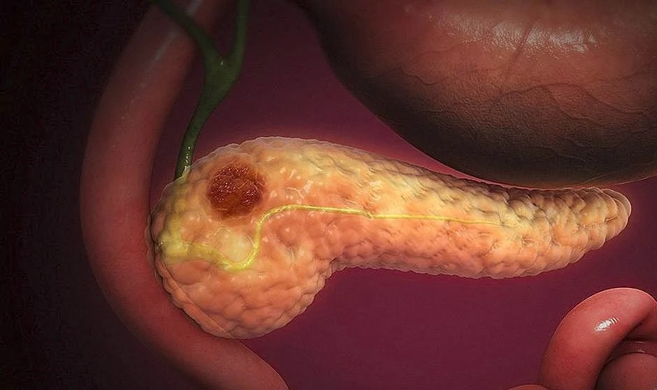 Pancreas. (Foto. Diario M&eacute;xico).
