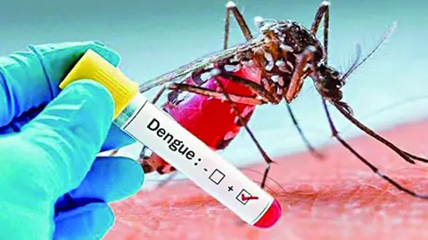Dengue.