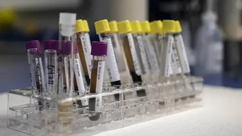 El coronavirus ataca m&aacute;s a este grupo sangu&iacute;neo