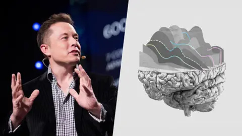 Elon Musk durante su presentaci&oacute;n en el evento de Neuralink. (Foto: Xataka).