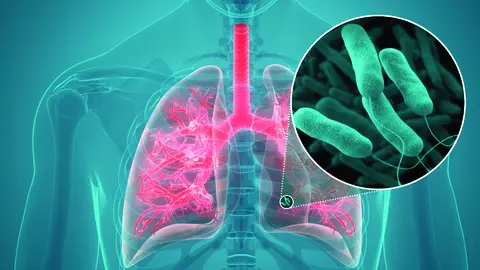 Infecci&oacute;n respiratoria, imagen referencial. (Foto: Healthy Swimming).