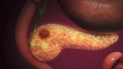 Pancreas. (Foto. Diario M&eacute;xico).